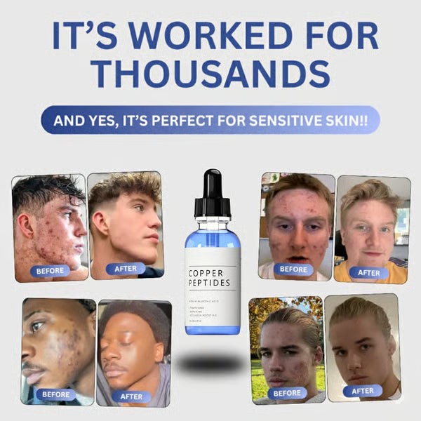 Topical GHK-Cu Serum